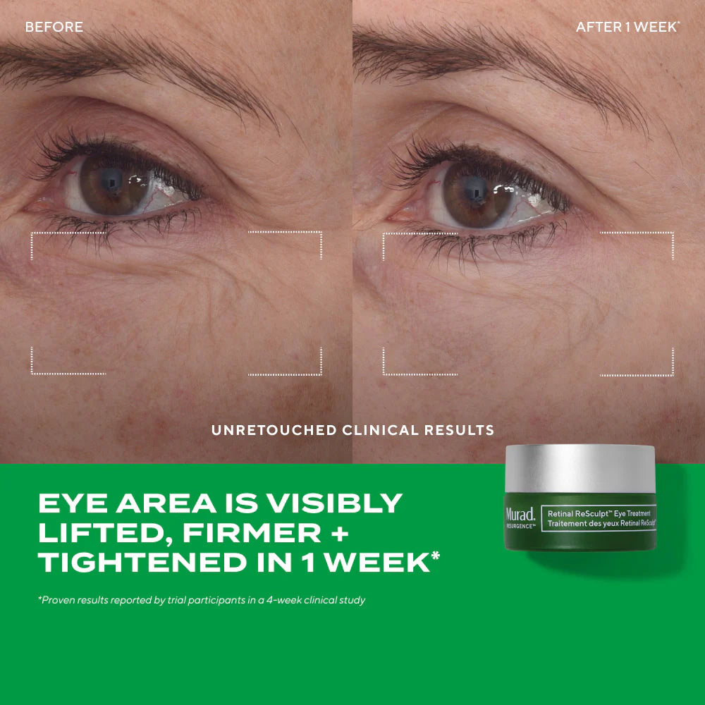 MURAD Retinol Resculpt Eye Treatment